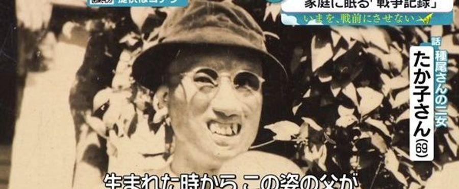 Rediscovering Life: The Post-War Journey of Disfigured Soldiers
