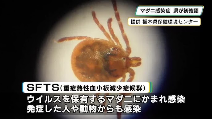 Tick-Borne Illness 'SFTS' Hits Record High in Japan