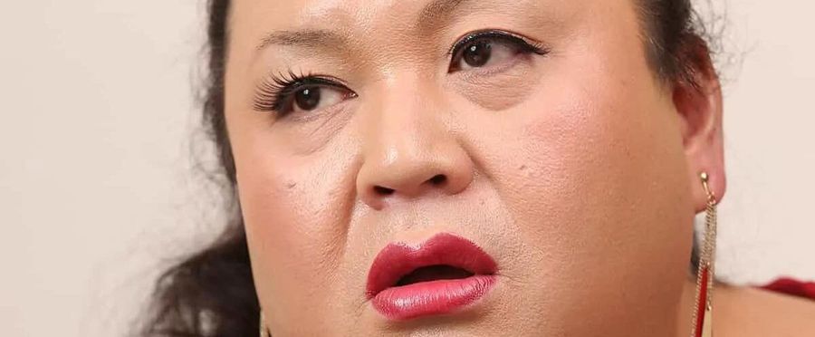 Popular TV Personality Matsuko Emergency Hospitalization: Agency Requests for Support