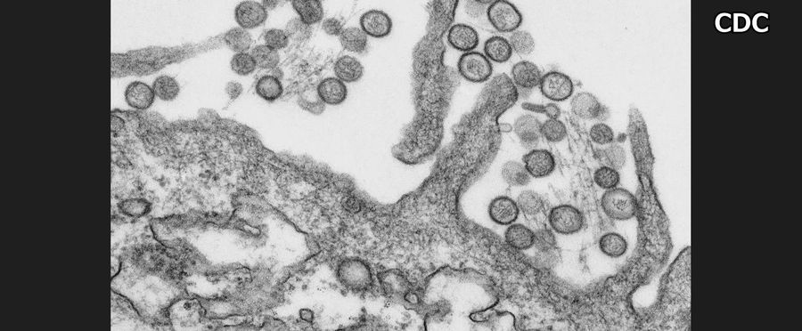 United States Reports Fatal Case of Hanta Virus: No Link to Ships
