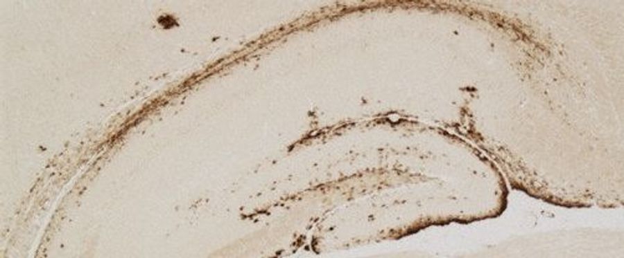 Unraveling Alzheimer's: Innovative Breakthroughs from Japanese Researchers